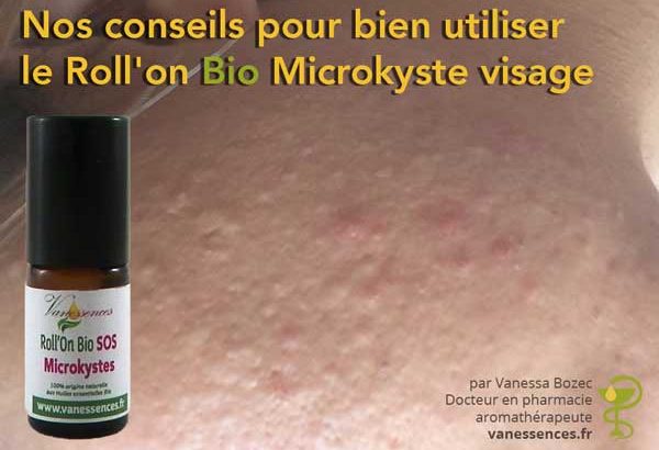 Conseils d'utilisation du roll'on bio microkyste visage vanessences.fr